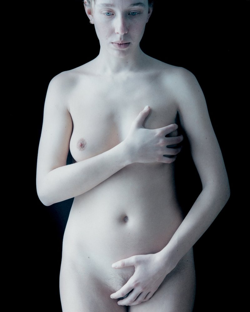 Девушка альбинос голая