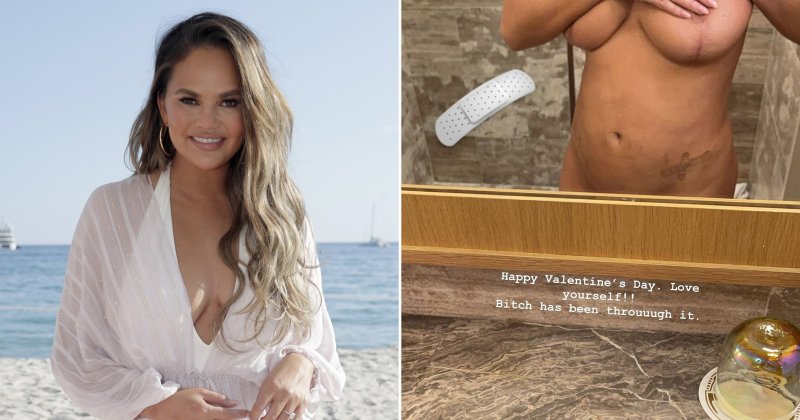 Chrissy teigen nude