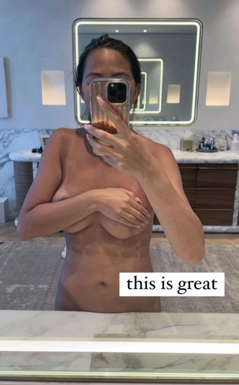 Chrissy teigen nude